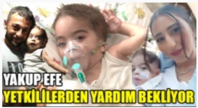 Minik Yakup Yetkililerden Yardım Bekliyor