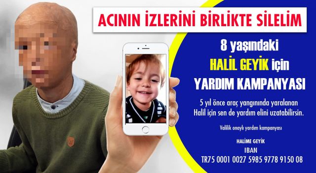 Araç yangınında yüzü yanan sekiz yaşındaki Halil yardım bekliyor