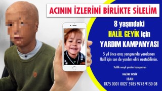 Araç yangınında yüzü yanan sekiz yaşındaki Halil yardım bekliyor