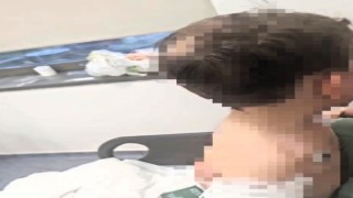 Vahşeti yaşayan 2 yaşındaki bebek hastanelik oldu